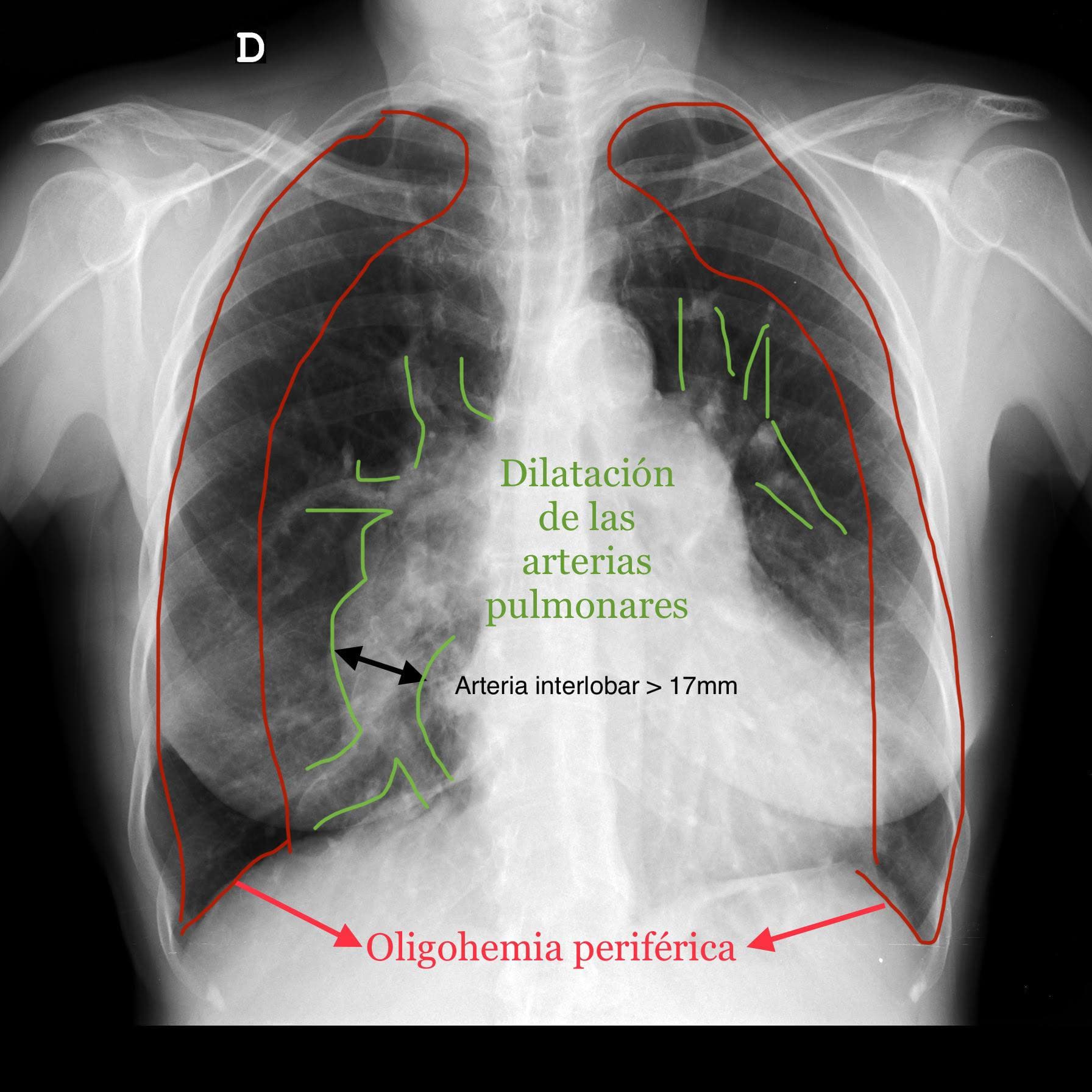 Lectura e Interpretación Radiológica
